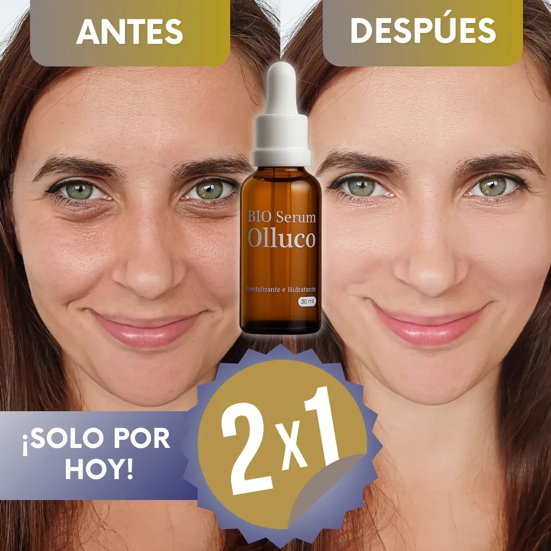 BIO® - Sérum de Olluco quita ojeras - Lleva 2 paga 1