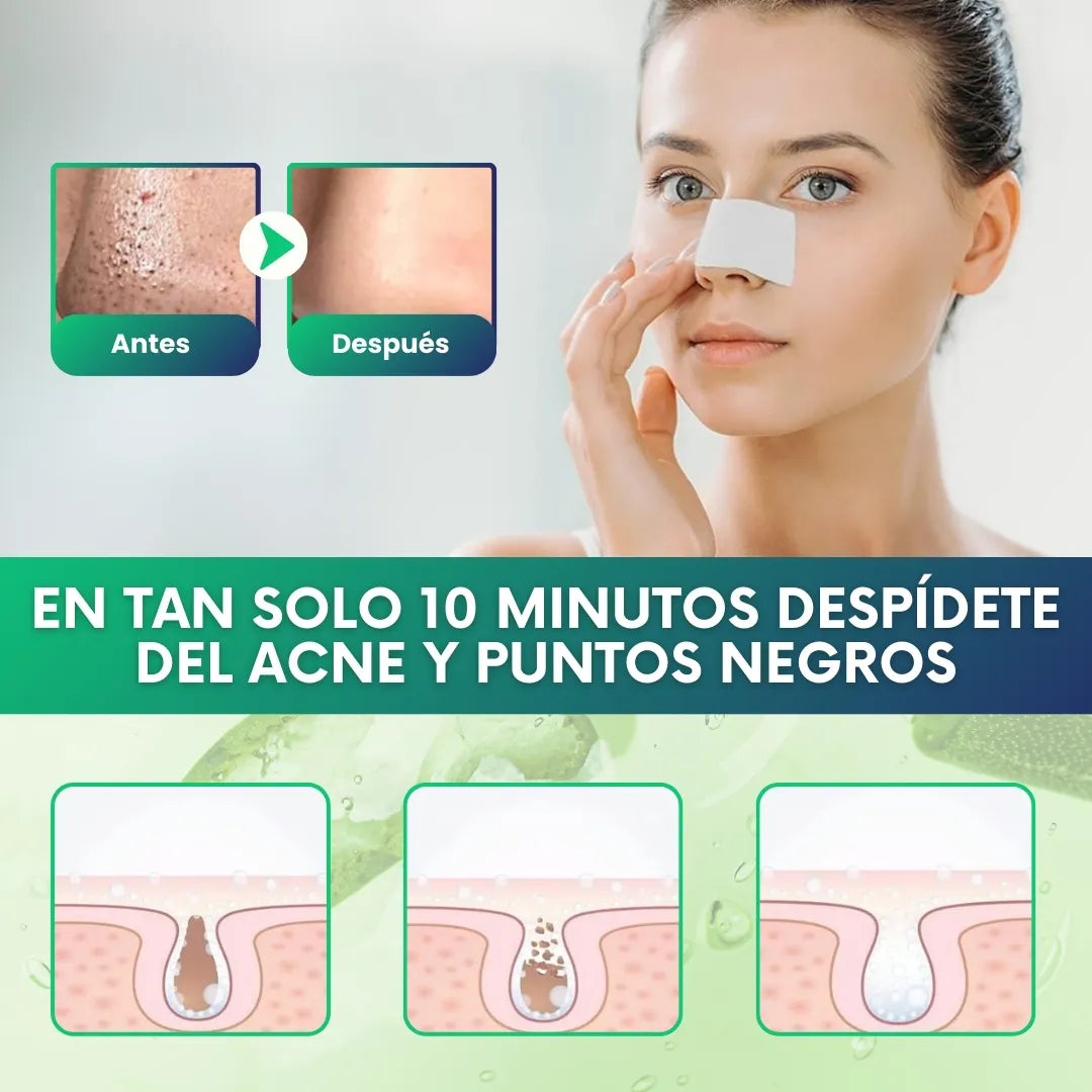Lanbena®: Mascarilla avanzada para puntos negros + 60 parches🎁