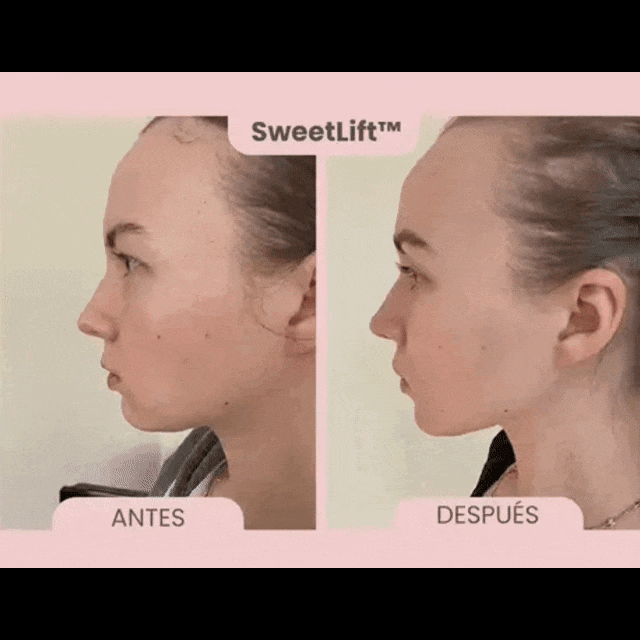 Masajeador facial Microcorriente -  Rostro perfilado y rejuvenecido en 5 minutos 💆‍♀️