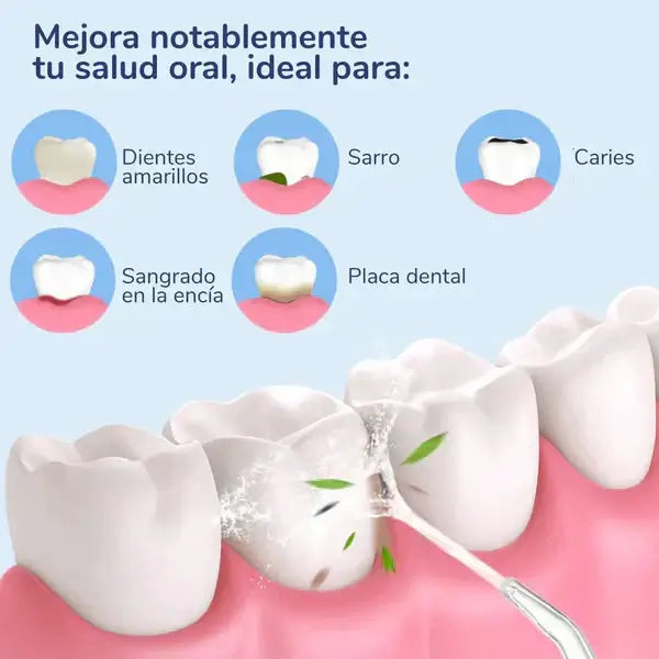 Irrigador bucal recargable - Combate el sarro y mal aliento