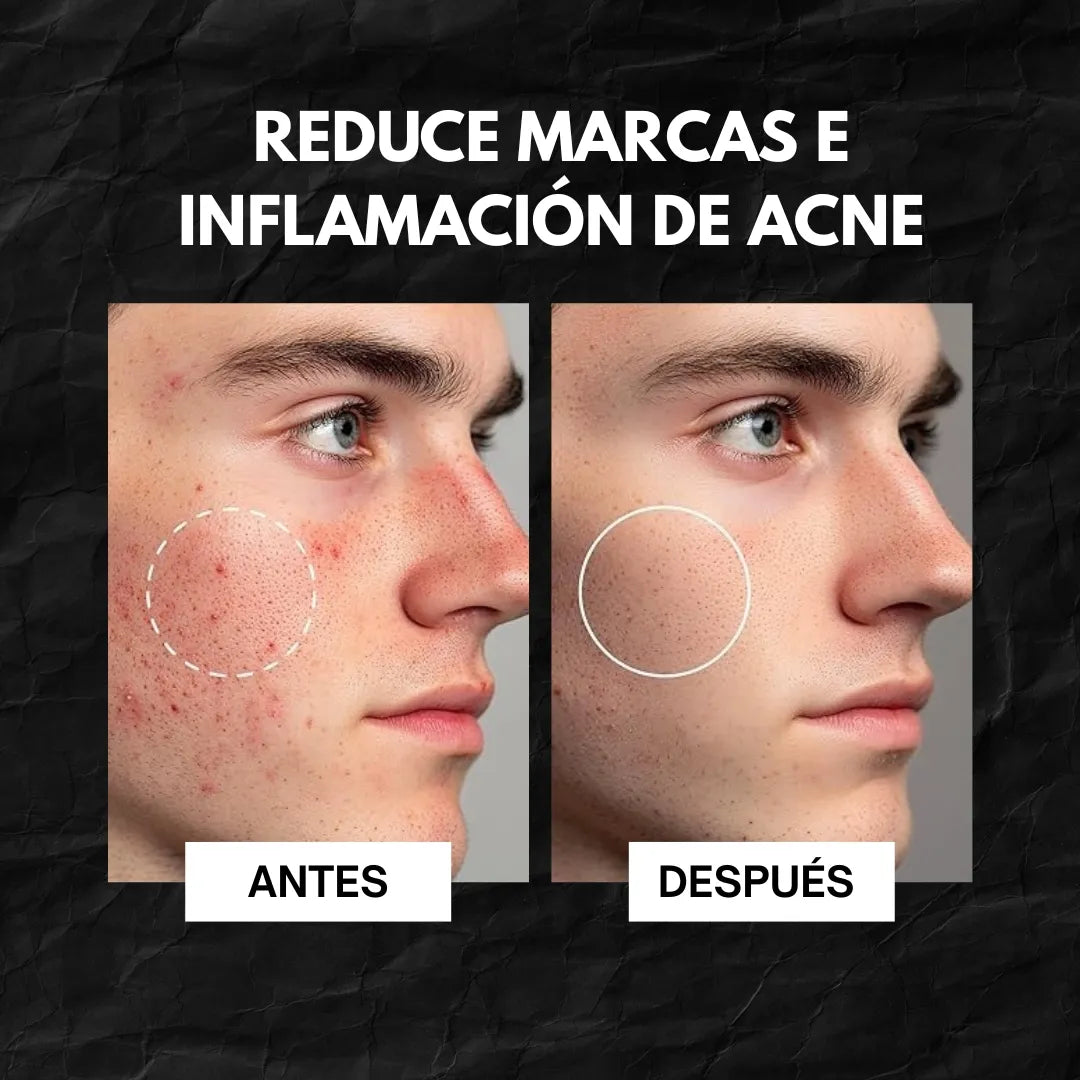 Gel limpiador facial - Abera Nolan