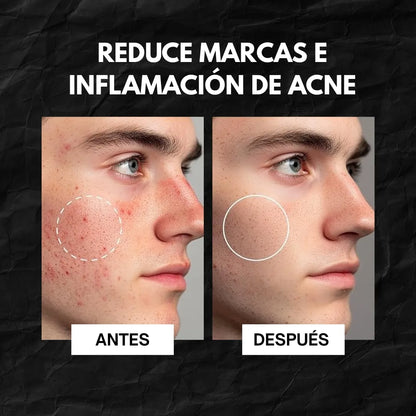 Gel limpiador facial - Abera Nolan